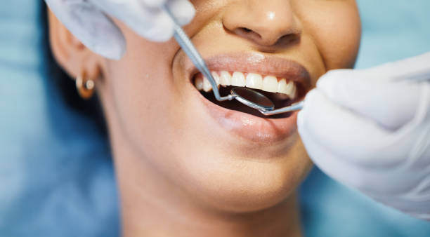 Best Mobile Emergency Dentist in Cimarron Hills, CO