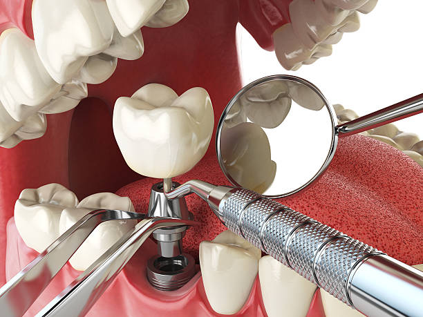 Best Emergency Dental Extractions in Cimarron Hills, CO